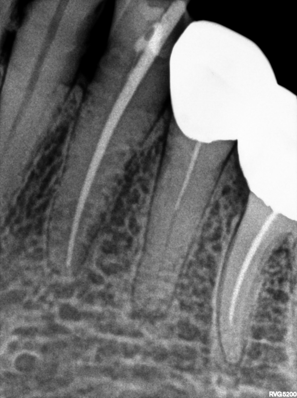 Dental X-ray
